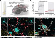 Autonomic neurorehabilitation abolished autonomic dysrefl exia in mice