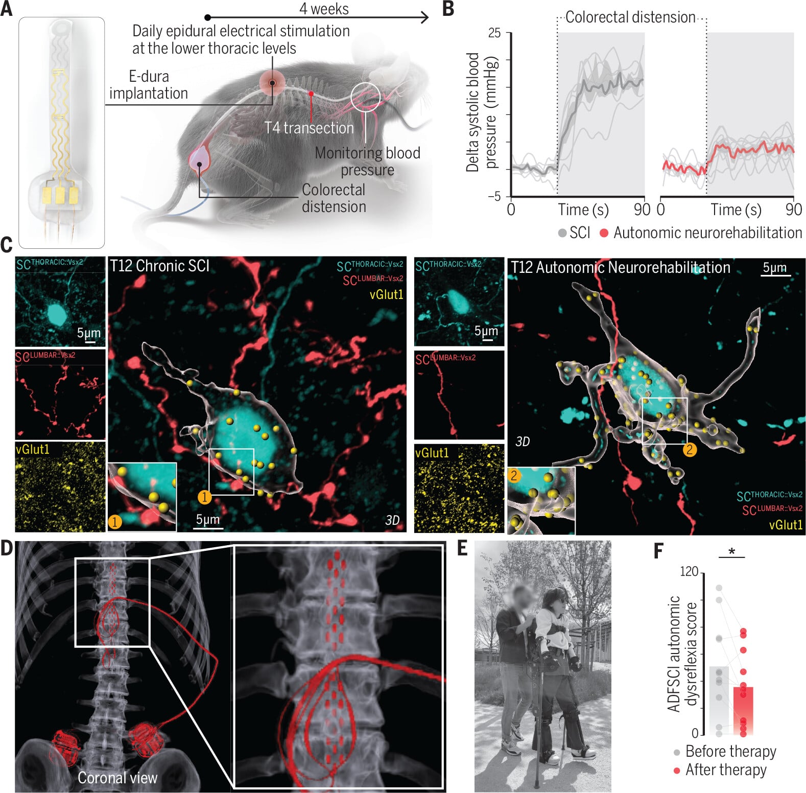 Autonomic neurorehabilitation abolished autonomic dysrefl exia in mice