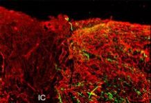 Ray of hope for spinal cord patients